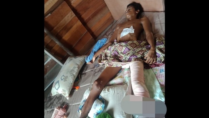 Kapolsek Tambang Bantu Warga Kualu Korban Laka Lantas Dengan Kondisi Menyedihkan