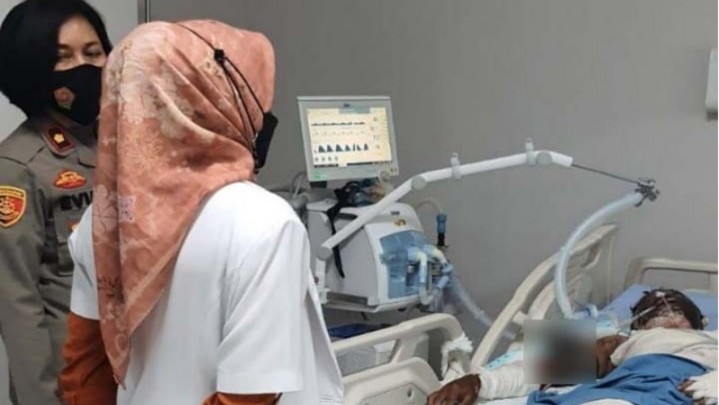 Pelaku Jambret yang Dibakar Massa Dikabarkan Meninggal Dunia