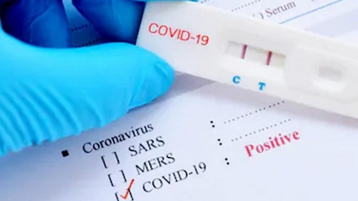 Bertambah 181 Orang Pasien Sembuh dari Covid-19 di Riau