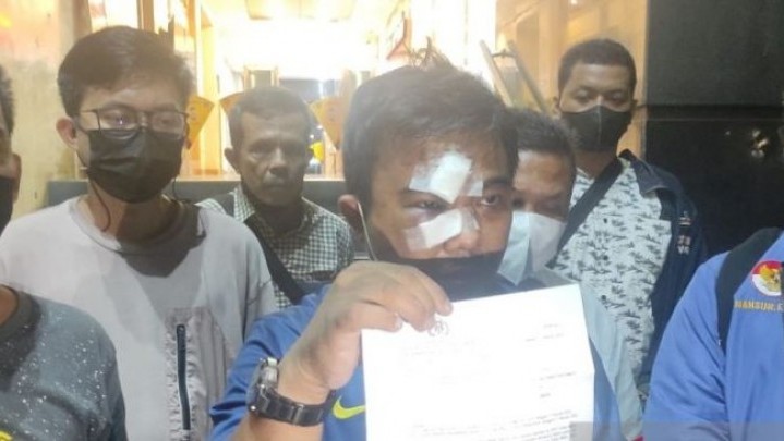 Ketua KNPI Haris Pertama Yakini Ada Dalang Pengeroyokan Dirinya Ketua KNPI Haris Pertama Yakini Ada Dalang Pengeroyokan Dirinya