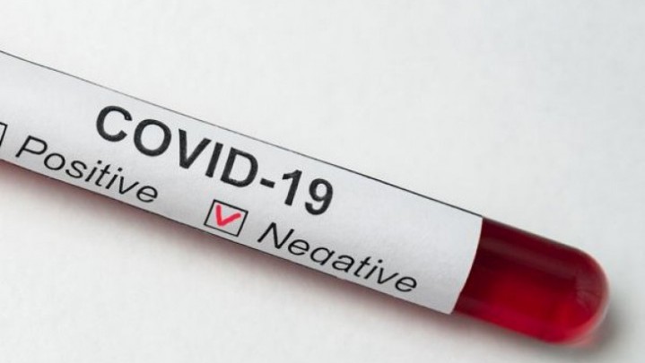 Bertambah Lagi 630 Orang Pasien Sembuh dari Covid-19 di Riau