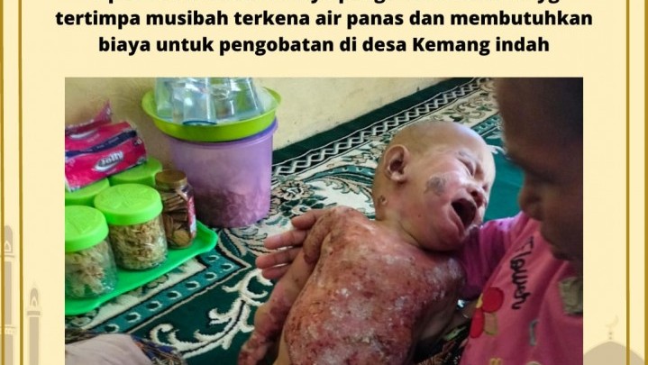 Mahasiswa Kemang Indah Galang Dana untuk M. Zahir yang Tersiram Air Panas Mahasiswa Kemang Indah Galang Dana untuk M. Zahir yang Tersiram Air Panas