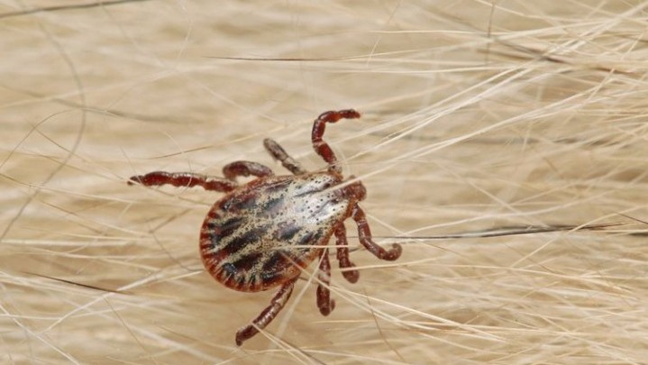 Wanita Lanjut Usia Meninggal Dunia Usai Digigit Kutu Wanita Lanjut Usia Meninggal Dunia Usai Digigit Kutu