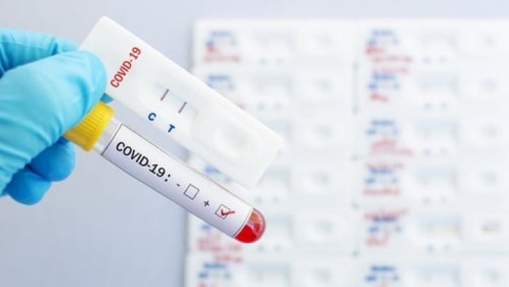 Penambahan Kasus Baru Covid-19 di Riau, 23 Orang dari Luar Provinsi