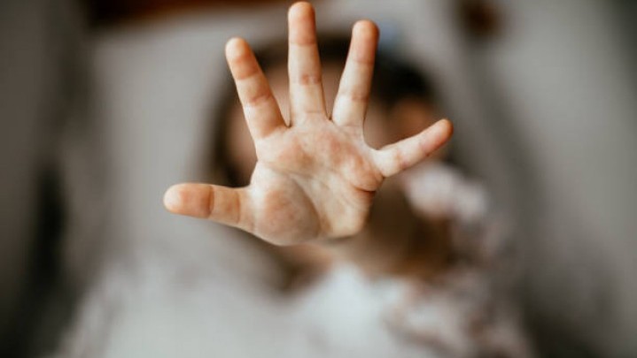 Di Kota Dumai Kekerasan Seksual pada Anak Meningkat