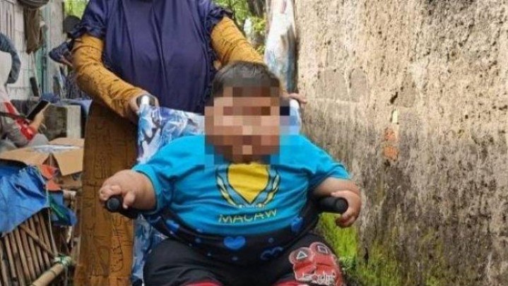 Bayi Obesitas di Bekasi Ternyata Sering Minum Susu Kental Manis Bayi Obesitas di Bekasi Ternyata Sering Minum Susu Kental Manis