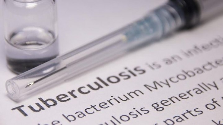 Berikut Sebaran Kasus TBC di Riau Berikut Sebaran Kasus TBC di Riau